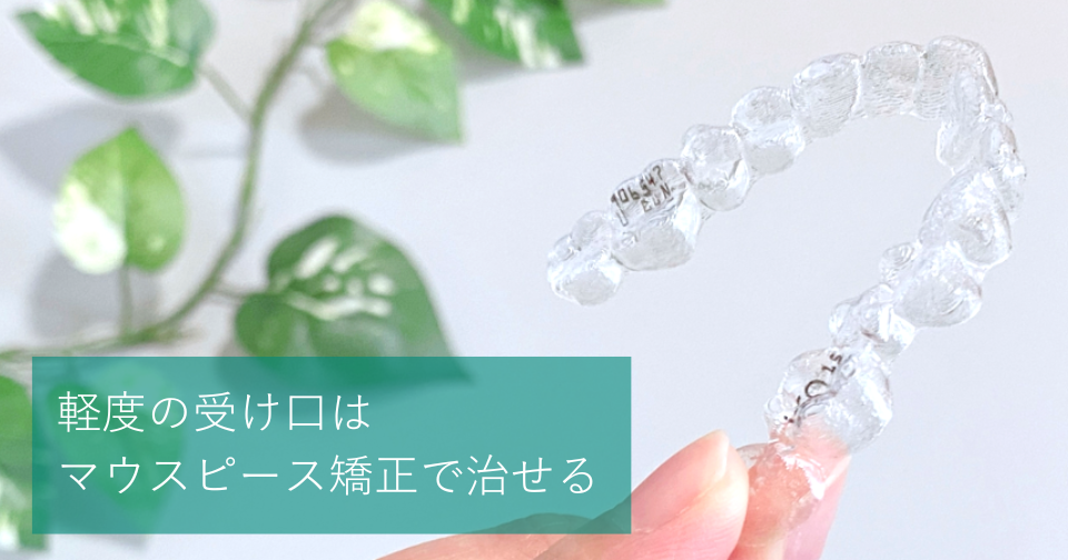 軽度の受け口はマウスピース矯正で治せる! | hanaravi歯科矯正blog 軽度の受け口はマウスピース矯正で治せる! | hanaravi歯科矯正blog