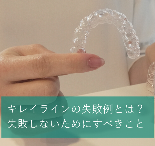 キレイラインの失敗例とは？失敗しないためにすべきこと