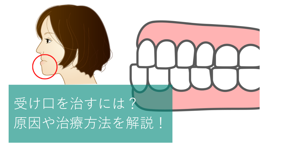 受け口を治すには 原因や治療方法を解説 Hanaravi歯科矯正blog