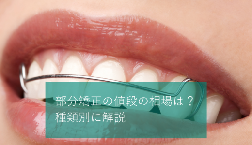 部分矯正の値段の相場は？一本だけ・前歯だけなど種類別に解説
