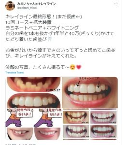 Oh my teethとキレイラインの違いは？通院の有無や提携クリニックなど解説 