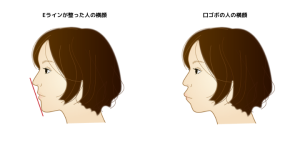 口ゴボとは？原因や治し方、よくある疑問を徹底解説！ 