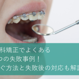 歯科矯正でよくある7つの失敗事例！防ぐ方法と失敗後の対応も解説！