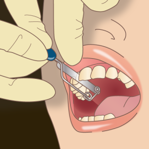 歯科矯正でよくある7つの失敗事例！防ぐ方法と失敗後の対応も解説！
