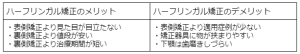 歯科矯正の種類を6つ解説！値段など比較ポイントや子供の矯正についても紹介