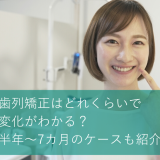 歯列矯正はどれくらいで変化がわかる？半年～7カ月のケースも紹介