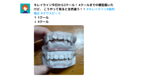 キレイラインの口コミを紹介！後悔しないためのポイントや特徴まで解説