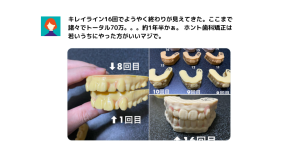 キレイラインの口コミを紹介！後悔しないためのポイントや特徴まで解説