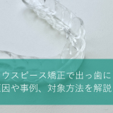 マウスピース矯正で出っ歯に？原因や事例、対象方法を解説