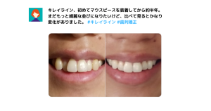 キレイラインの症例写真10選！事例や特徴、口コミ、よくある質問も