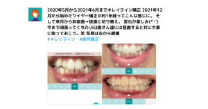 キレイラインの症例写真10選！事例や特徴、口コミ、よくある質問も