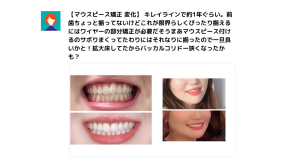 キレイラインの症例写真10選！事例や特徴、口コミ、よくある質問も