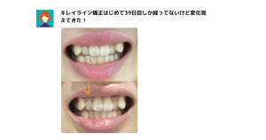 キレイラインの症例写真10選！事例や特徴、口コミ、よくある質問も