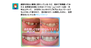キレイラインの症例写真10選！事例や特徴、口コミ、よくある質問も