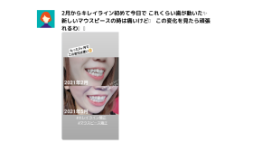 キレイラインの症例写真10選！事例や特徴、口コミ、よくある質問も