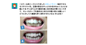 キレイラインの症例写真10選！事例や特徴、口コミ、よくある質問も