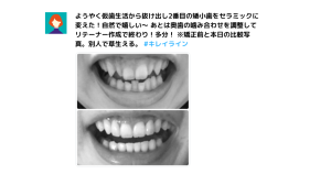 キレイラインの症例写真10選！事例や特徴、口コミ、よくある質問も