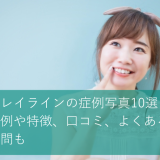 キレイラインの症例写真10選！事例や特徴、口コミ、よくある質問も