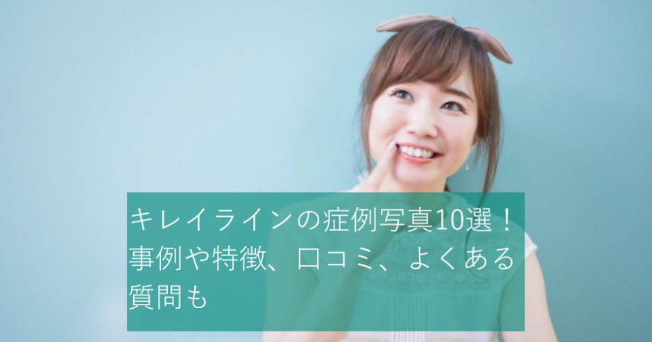 キレイラインの症例写真10選！事例や特徴、口コミ、よくある質問も