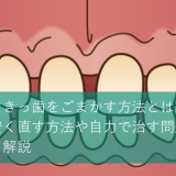 すきっ歯をごまかす方法とは？安く直す方法や自力で治す問題も解説