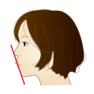 なぜ歯並びは良いけど口ゴボになるのか？その原因や治療法を解説します