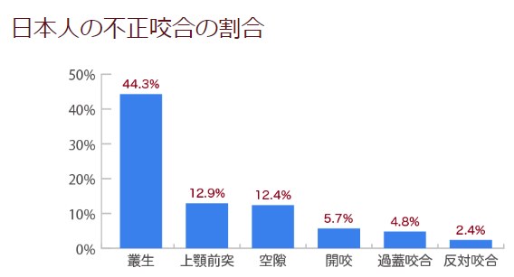日本人の不正咬合の割合。叢生は44.3％で、最も多い不正咬合です。