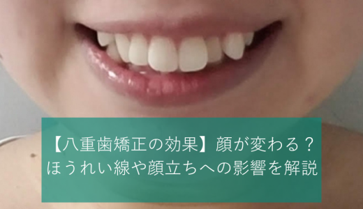 【八重歯矯正の効果】顔が変わる？ほうれい線や顔立ちへの影響を解説