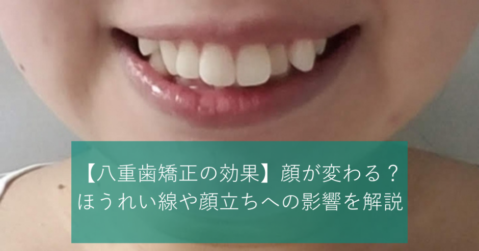 【八重歯矯正の効果】顔が変わる？ほうれい線や顔立ちへの影響を解説