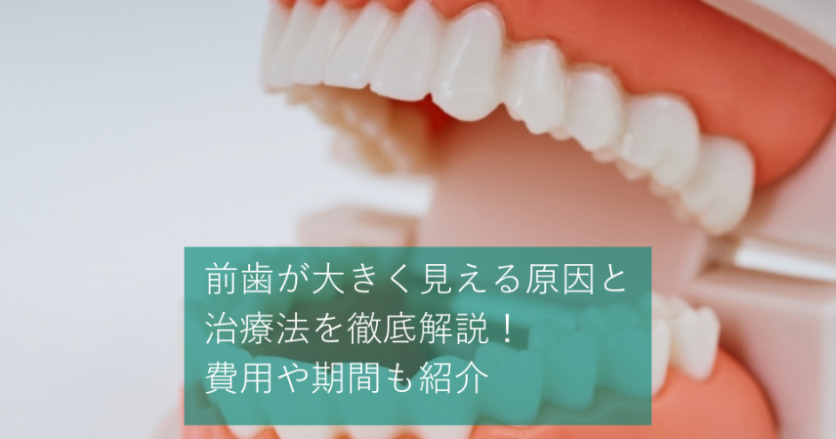 前歯が大きく見える原因と治療法を徹底解説 | 費用や期間も紹介