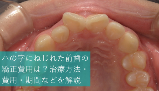 ハの字にねじれた前歯の矯正費用は？治療方法・費用・期間などを解説