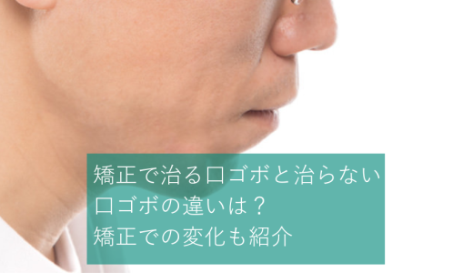 矯正で治る口ゴボと治らない口ゴボの違いは？矯正での変化も紹介