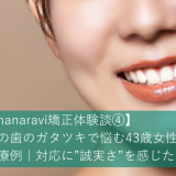【hanaravi矯正体験談④】下の歯のガタツキで悩む43歳女性の治療例｜対応に”誠実さ”を感じた