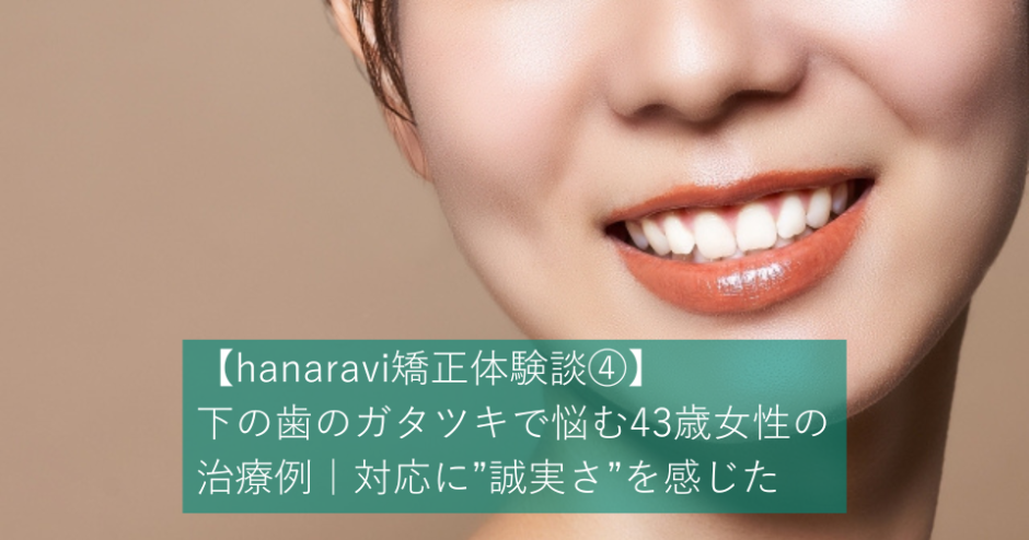 【hanaravi矯正体験談④】下の歯のガタツキで悩む43歳女性の治療例｜対応に”誠実さ”を感じた