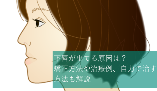 下唇が出てる原因は？矯正方法や治療例、自力で治す方法も解説