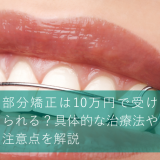 部分矯正は10万円で受けられる？具体的な治療法や注意点を解説
