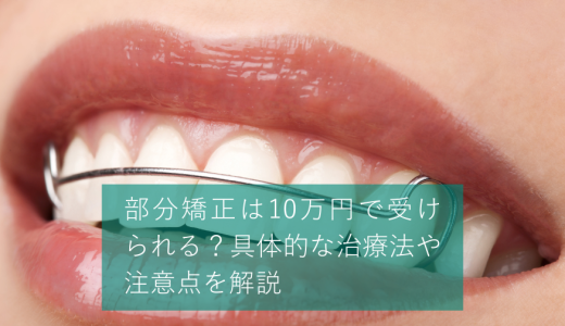 部分矯正は10万円で受けられる？具体的な治療法や注意点を解説