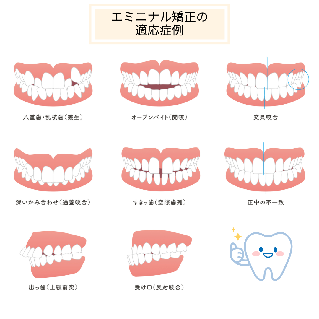 エミニナル矯正の適応症例