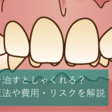 過蓋咬合を治すとしゃくれる？最適な矯正法や費用・リスクを解説