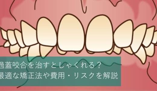 過蓋咬合を治すとしゃくれる？最適な矯正法や費用・リスクを解説