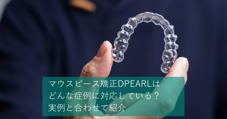 マウスピース矯正DPEARL（ディパール）はどんな症例に対応している？実例と合わせて紹介