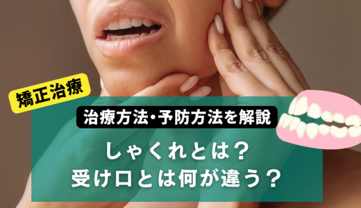 しゃくれとは？受け口とは何が違う？治療方法・予防方法を解説