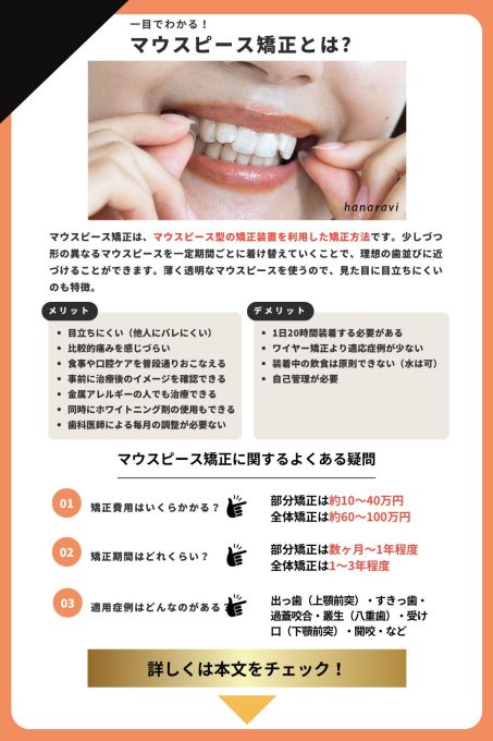 マウスピース矯正についての解説画像。特徴、メリット・デメリット、費用、期間、対応症例について解説、
