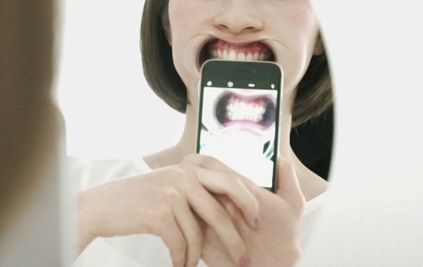 スマートフォンで口腔内を撮影する女性